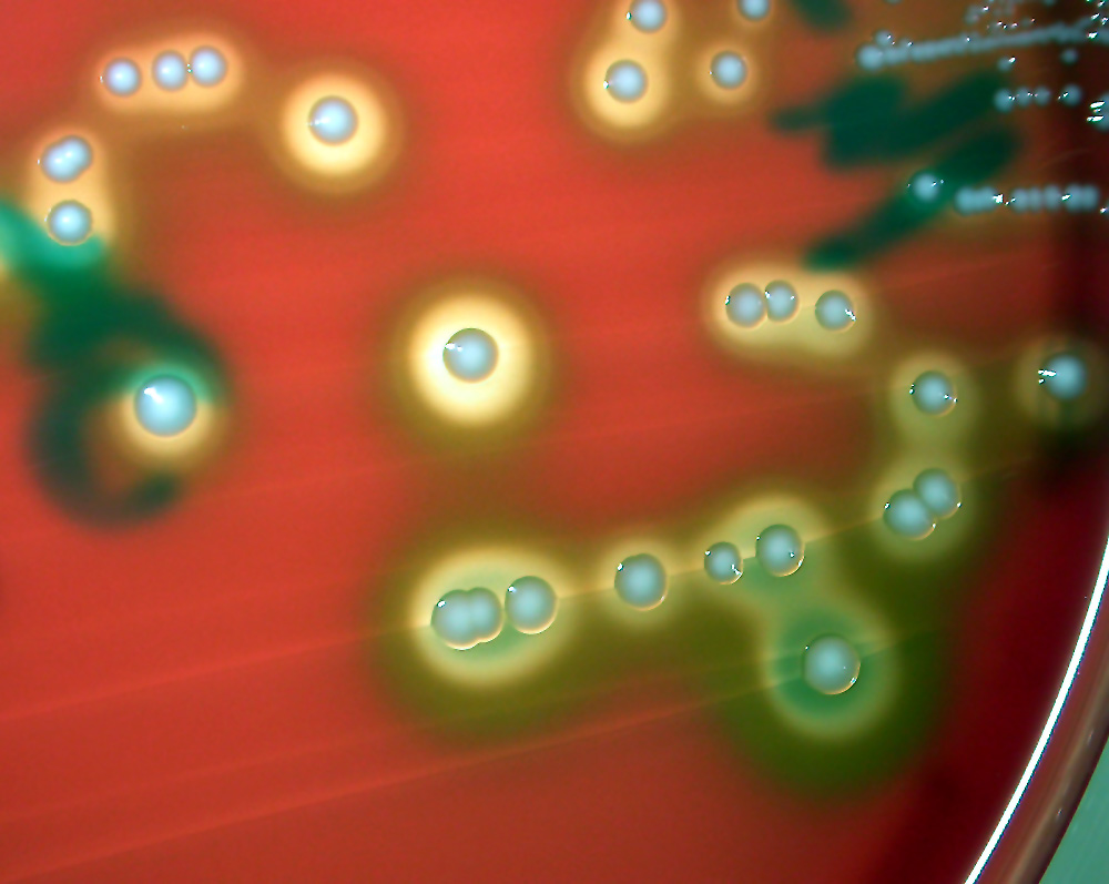 Aerococcus urinae
Aerococcus sind grampositive Kokken die bei älteren und immunschwachen Leuten Harnwegsinfekte verursachen können. Sie wachsen aerob und bauen nach einigen Tagen Schaferythrozyten ab, unter einer grösseren Vergrünung um die Kolonien. 
Schlüsselwörter: Aerococcus urinae