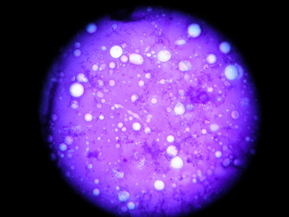 Gefärbter Ei-Inhalt von Archioptera spinosissima
Stabschrecke Archioptera spinosissima
Schlüsselwörter: Ei-Inhalt, Stabheuschrecke, Stabschrecke, Archioptera spinosissima