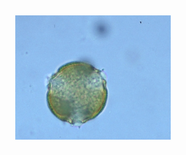 Pollen von Euphorbia viguieri var capuroniana
3-poriger Pollen von Euphorbia viguieri var capuroniana, ca 400 fache Vergrösserung.
Schlüsselwörter: Pollen, Euphorbia viguieri var capuroniana